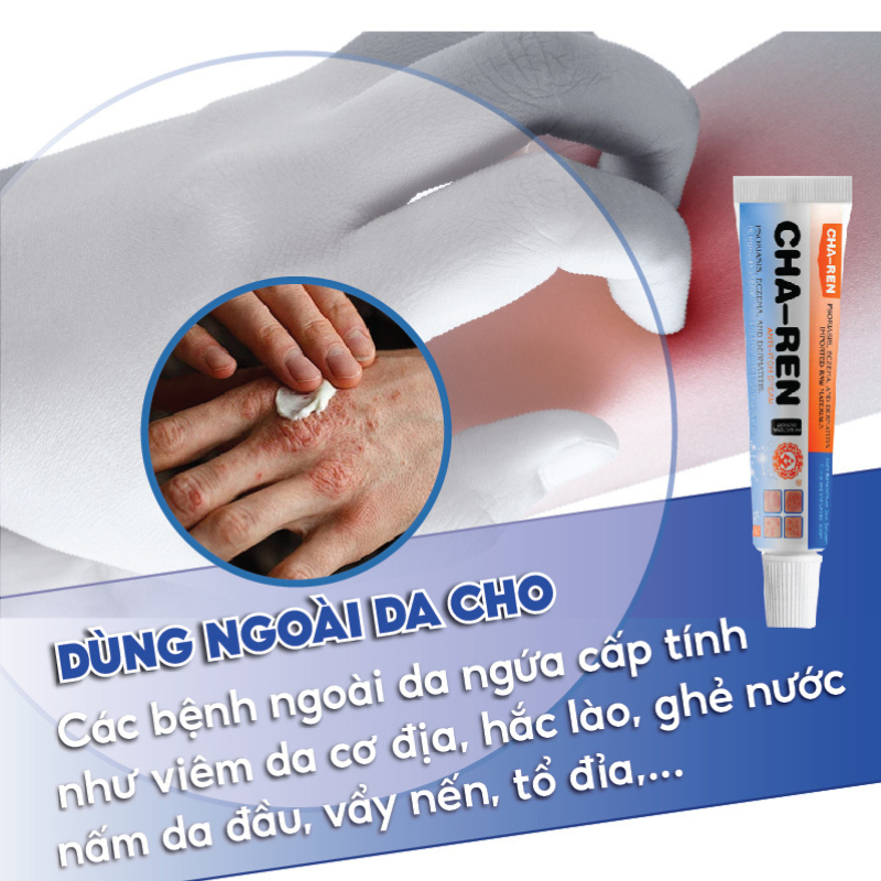 Kem Bôi Nấm Ngứa Viêm Da Cơ Địa CHA-REN Hàng Xuất Khẩu Châu Âu (EU) Dứt Điểm Hắc Lào, Nấm Da Đầu
