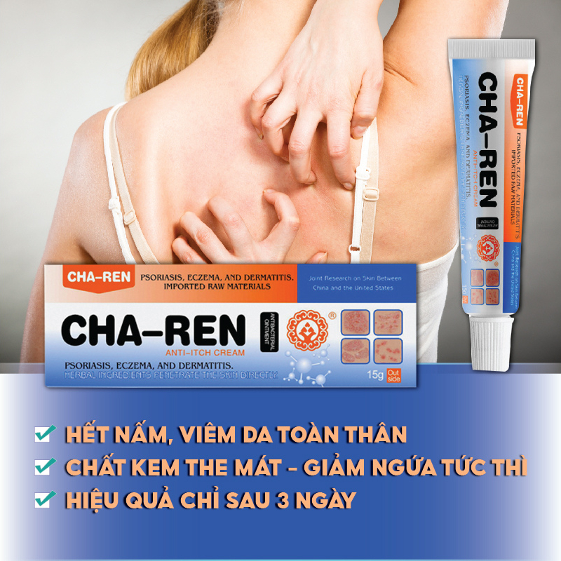 Kem Bôi Nấm Ngứa Viêm Da Cơ Địa CHA-REN Hàng Xuất Khẩu Châu Âu (EU) Dứt Điểm Hắc Lào, Nấm Da Đầu