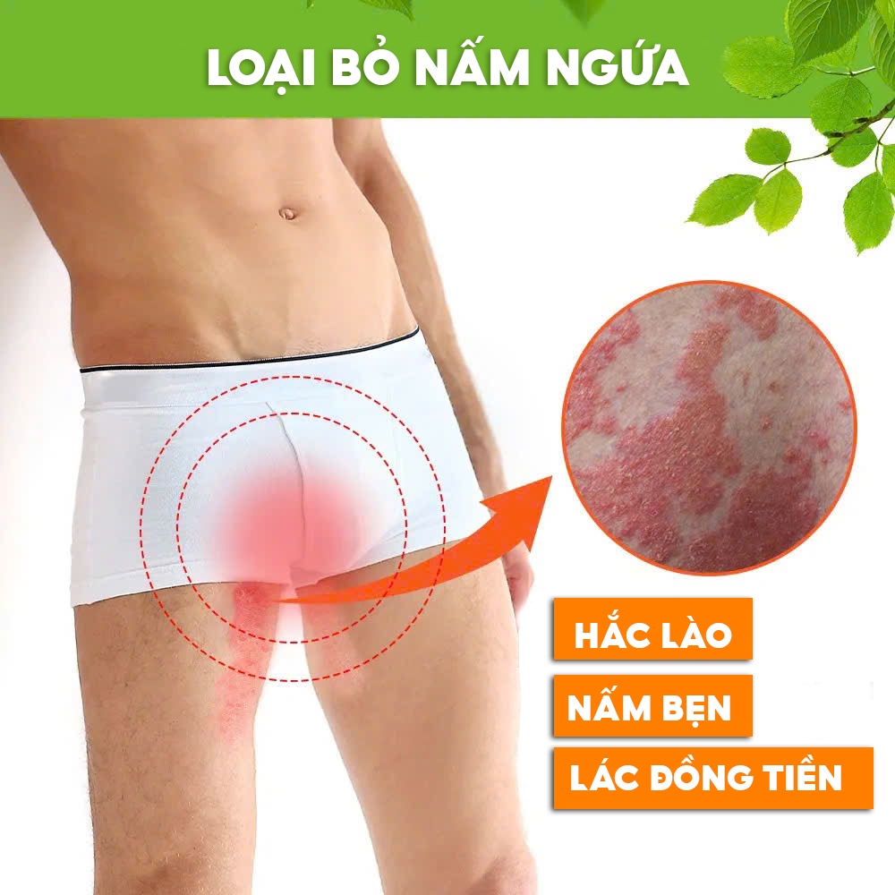 Kem Bôi Nấm Ngứa Viêm Da Cơ Địa CHA-REN Hàng Xuất Khẩu Châu Âu (EU) Dứt Điểm Hắc Lào, Nấm Da Đầu