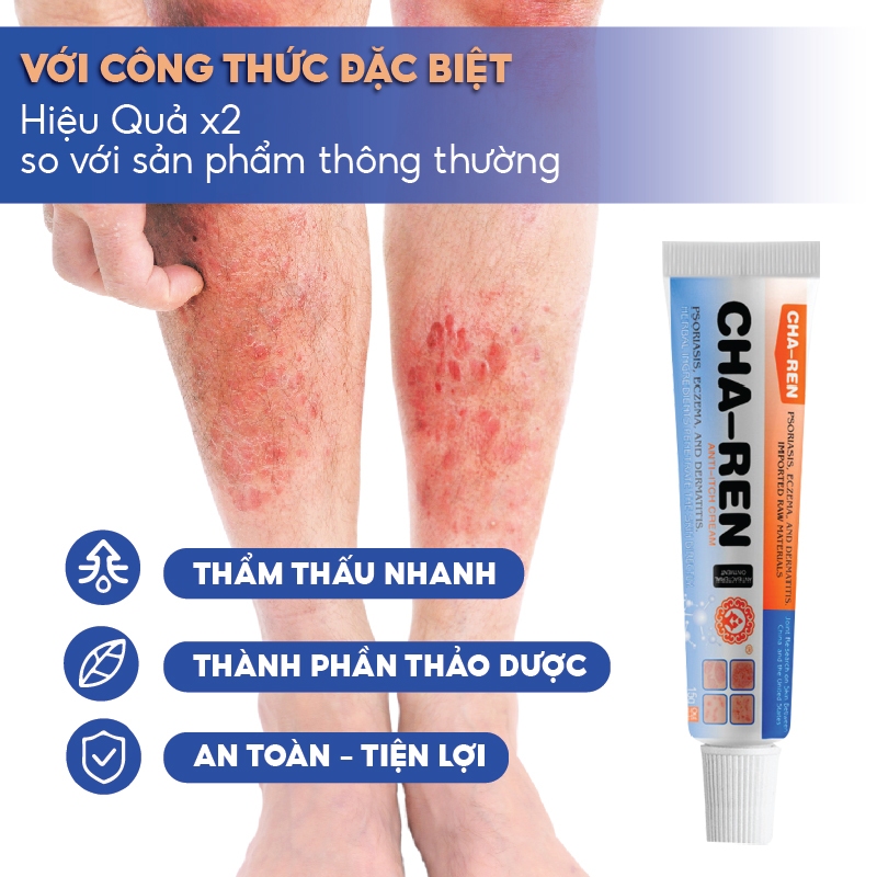 Kem Bôi Nấm Ngứa Viêm Da Cơ Địa CHA-REN Hàng Xuất Khẩu Châu Âu (EU) Dứt Điểm Hắc Lào, Nấm Da Đầu