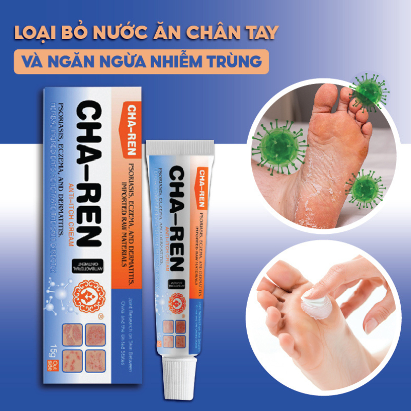 Kem Bôi Nấm Ngứa Viêm Da Cơ Địa CHA-REN Hàng Xuất Khẩu Châu Âu (EU) Dứt Điểm Hắc Lào, Nấm Da Đầu