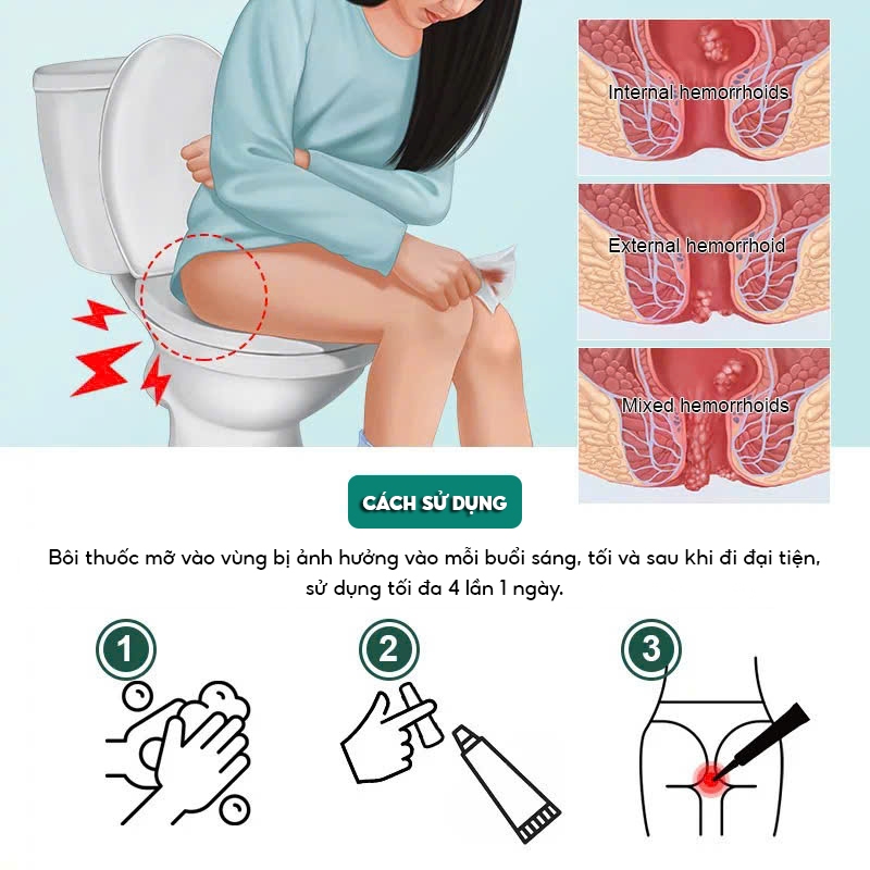 Kem Bôi Trĩ Nội Ngoại Hỗn Hợp CHA-REN Hàng Xuất Khẩu Châu Âu (EU) Giúp Co Trĩ Giảm Đau Rát Hậu Môn