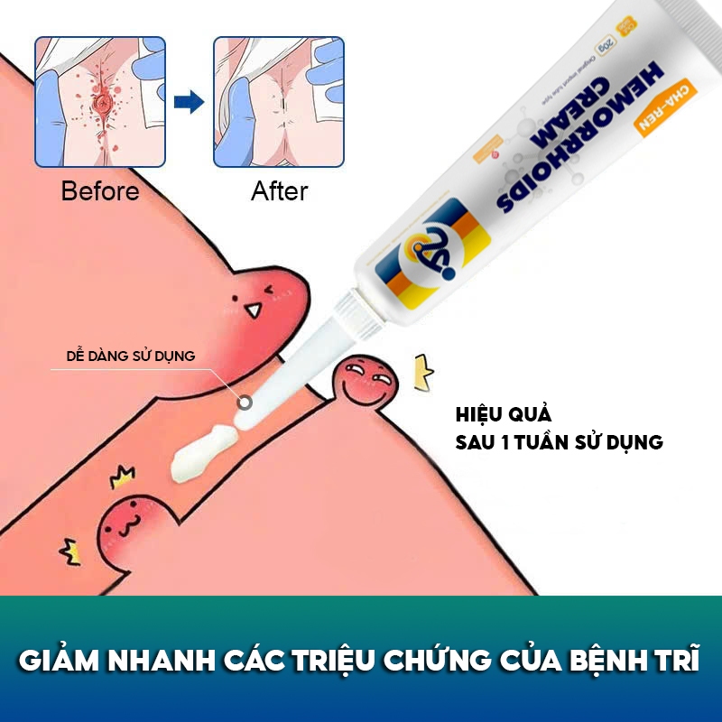 Kem Bôi Trĩ Nội Ngoại Hỗn Hợp CHA-REN Hàng Xuất Khẩu Châu Âu (EU) Giúp Co Trĩ Giảm Đau Rát Hậu Môn