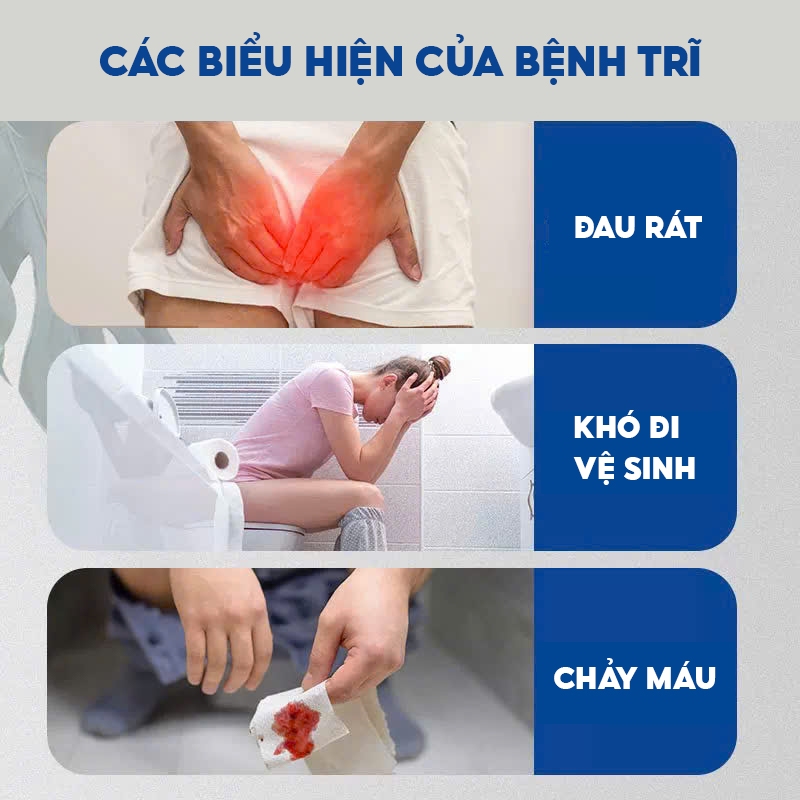Kem Bôi Trĩ Nội Ngoại Hỗn Hợp CHA-REN Hàng Xuất Khẩu Châu Âu (EU) Giúp Co Trĩ Giảm Đau Rát Hậu Môn