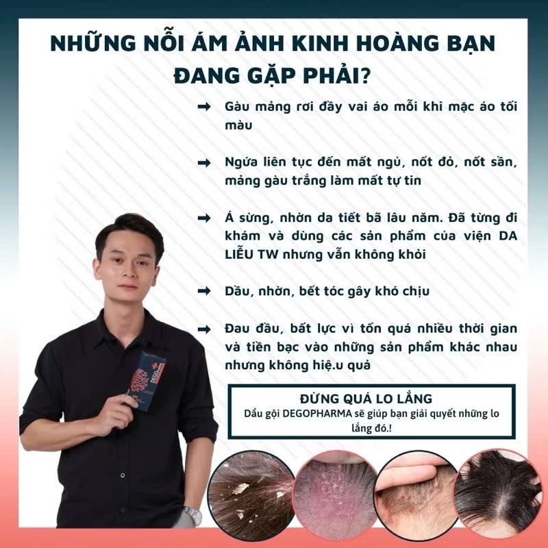 Combo 3 Dầu Gội Đầu DEGO PHARMA 80ml Dứt Điểm Gàu Ngứa Nấm Da Đầu & Viêm Da Tiết Bã ...
