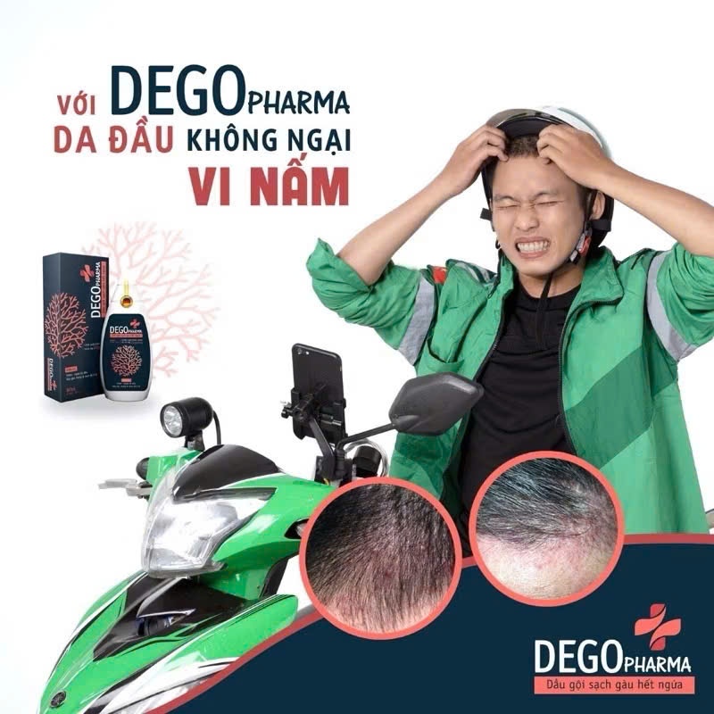 Dầu Gội Đầu DEGO PHARMA 80ml Dứt Điểm Gàu Ngứa Nấm Da Đầu & Viêm Da Tiết Bã,,,,,,