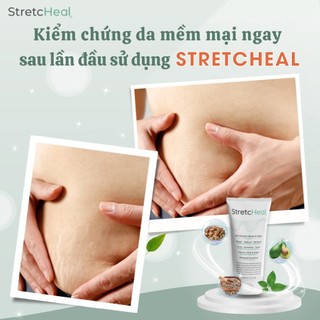 [CÔNG TY] Kem Chống Rạn StretcHeal Chính Hãng Made in USA