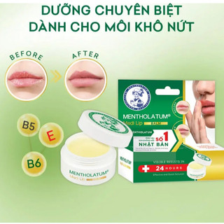 Sáp Dưỡng Môi Chuyên Biệt Cho Môi Khô, Nứt Nẻ Mentholatum Medi Lip (7g/4.3g)