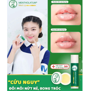 Sáp Dưỡng Môi Chuyên Biệt Cho Môi Khô, Nứt Nẻ Mentholatum Medi Lip (7g/4.3g)