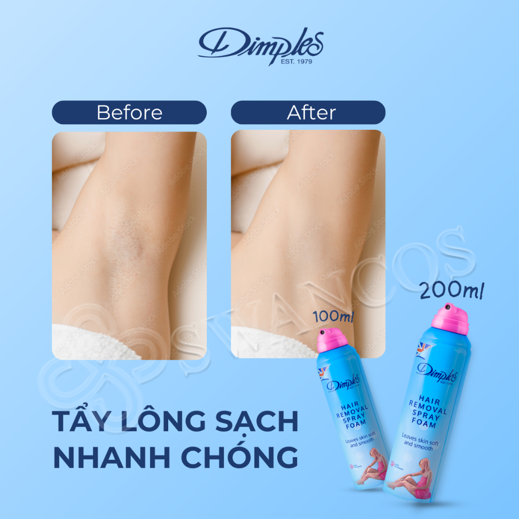 Xịt Tẩy Lông Châu Âu DIMPLES Dạng Bọt Hương Hoa Hồng Dành Cho Chân, Tay, Nách Không Gây Kích Ứng