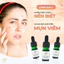Serum mụn Anti Blemish 5ml ADA Group