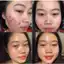 Serum mụn Anti Blemish 5ml ADA Group
