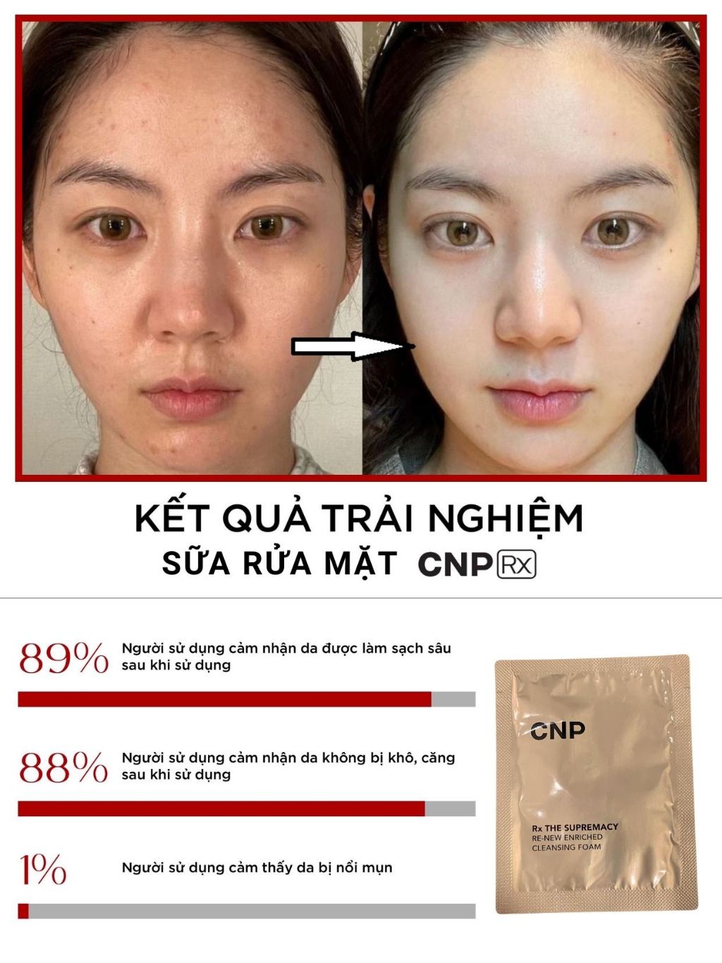 10 Gói Sữa Rửa Mặt CNP Rx Vàng Supremacy Cleansing Foam 2mL | Shopee ...