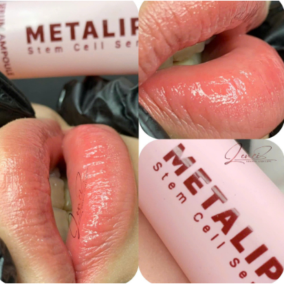 Metalips dưỡng môi cao cấp dùng trong phun xăm thẩm mĩ