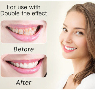 Máy Làm Trắng Răng Smilekit S5 Kèm 4 Ống Gel Hiệu Quả, Nhanh Không Ê Buốt, Bảo Hành 24 Tháng