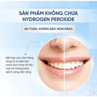 Máy Làm Trắng Răng Smilekit S5 Kèm 4 Ống Gel Hiệu Quả, Nhanh Không Ê Buốt, Bảo Hành 24 Tháng