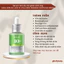 Serum làm dịu da giảm kích ứng ANUA Azelaic Acid 10 Hyaluron Redness Soothing Serum 30ml [Glow Beauty]