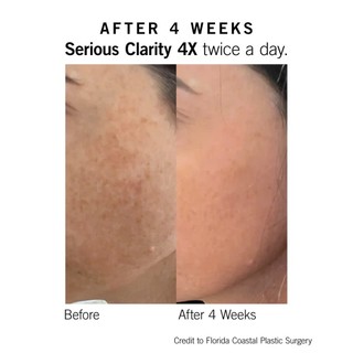 Serum Dưỡng Trắng Sáng, Mờ Thâm Nám Neova Serious Clarity 4x 30ml