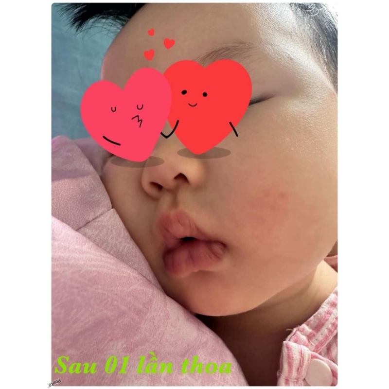Dầu thảo dược Dr Huang (50g)( Mua 8 hộp tặng 1 hộp)