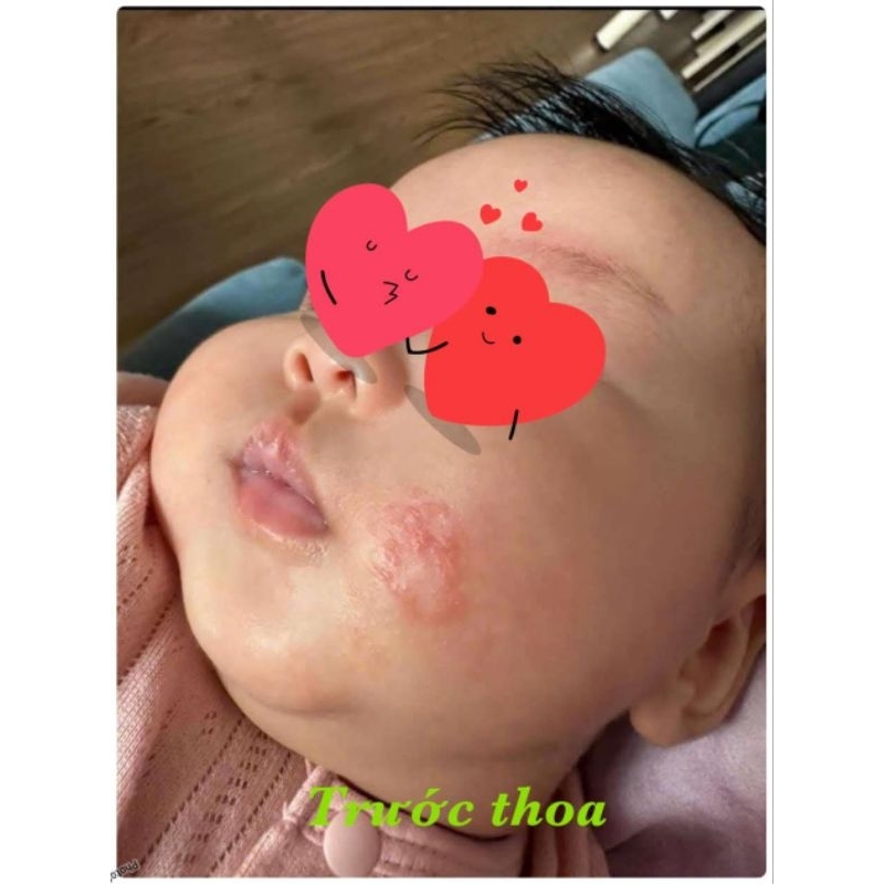 Dầu thảo dược Dr Huang (50g)(Mua 8 tặng 1)
