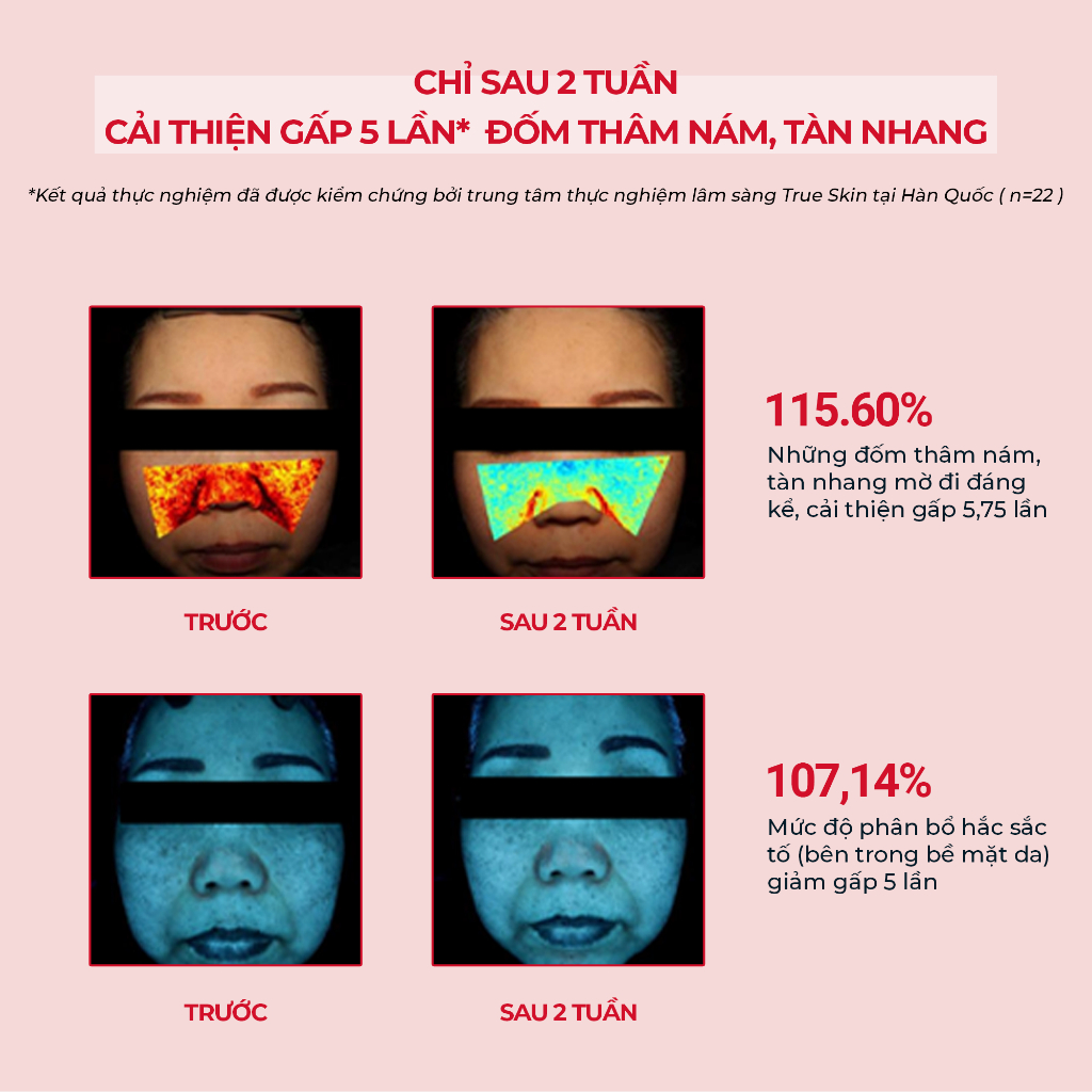 [Angel's Liquid] Kem Dưỡng Cải Thiện Thâm Nám Angel's Liquid Tranexamic Mela Zero Cream 50ml (ĐỎ)