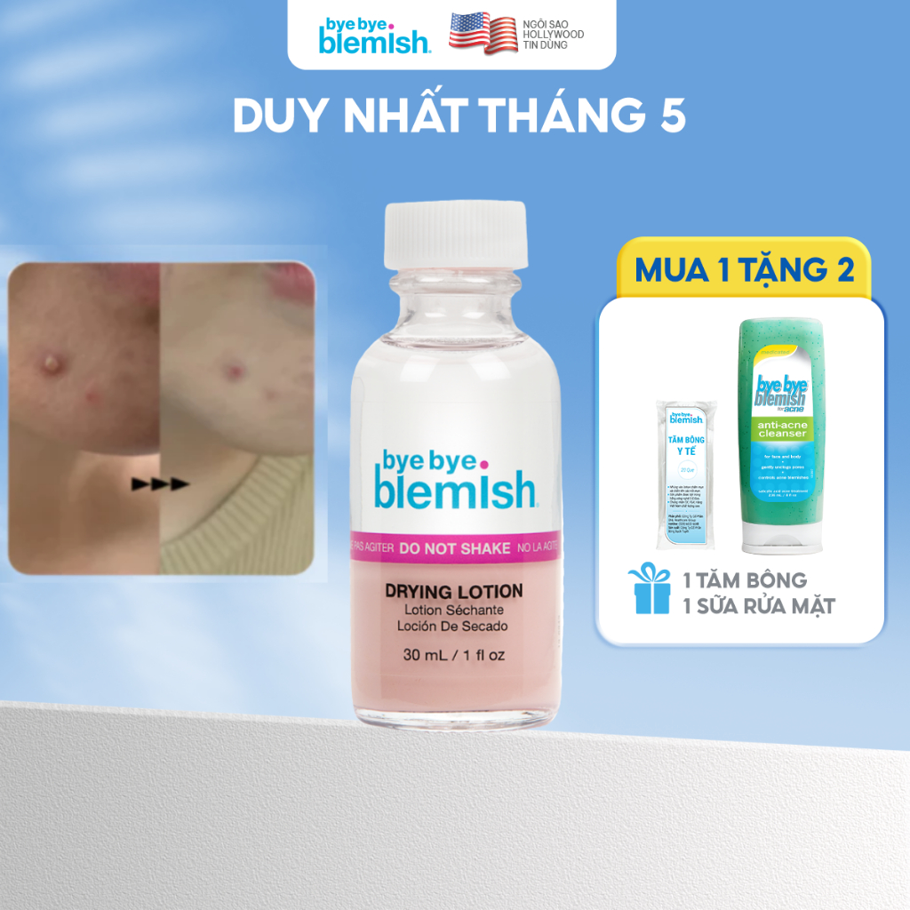 Ảnh Chấm Mụn Giảm Mụn Nhanh Sau 1 Đêm Dành Cho Mụn Trắng, Sưng Đỏ, Da Nhạy Cảm Bye Bye Blemish Original Drying Lotion 30ml 1