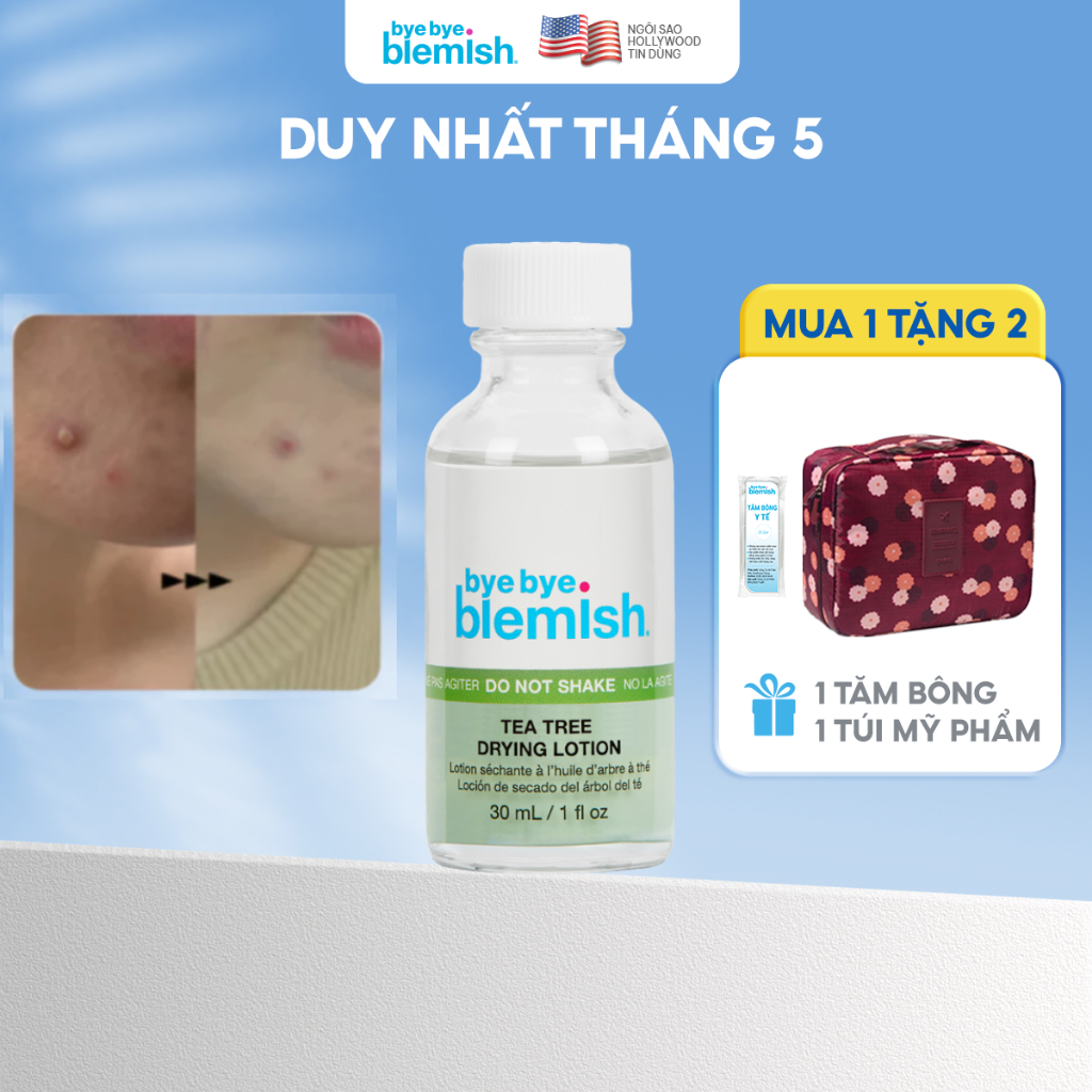 Ảnh Chấm mụn Tràm Trà dành cho mụn viêm, mụn body Bye Bye Blemish Tea Tree Drying Lotion 30ml 1