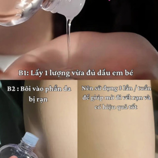 Dầu Massage Dưỡng Ẩm Da Baby Oil Johnson's (50ml, 200ml)