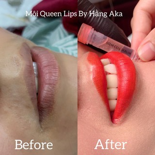 Dưỡng Stem Cell Serum Dành Cho Môi Sau Phun Xăm - Dcpxhoanganh