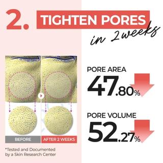 Nước hoa hồng dạng miếng NUMBUZIN No.4 Pore Zero Peeled Egg hỗ trợ se khít lỗ chân lông 70Pads/190ml