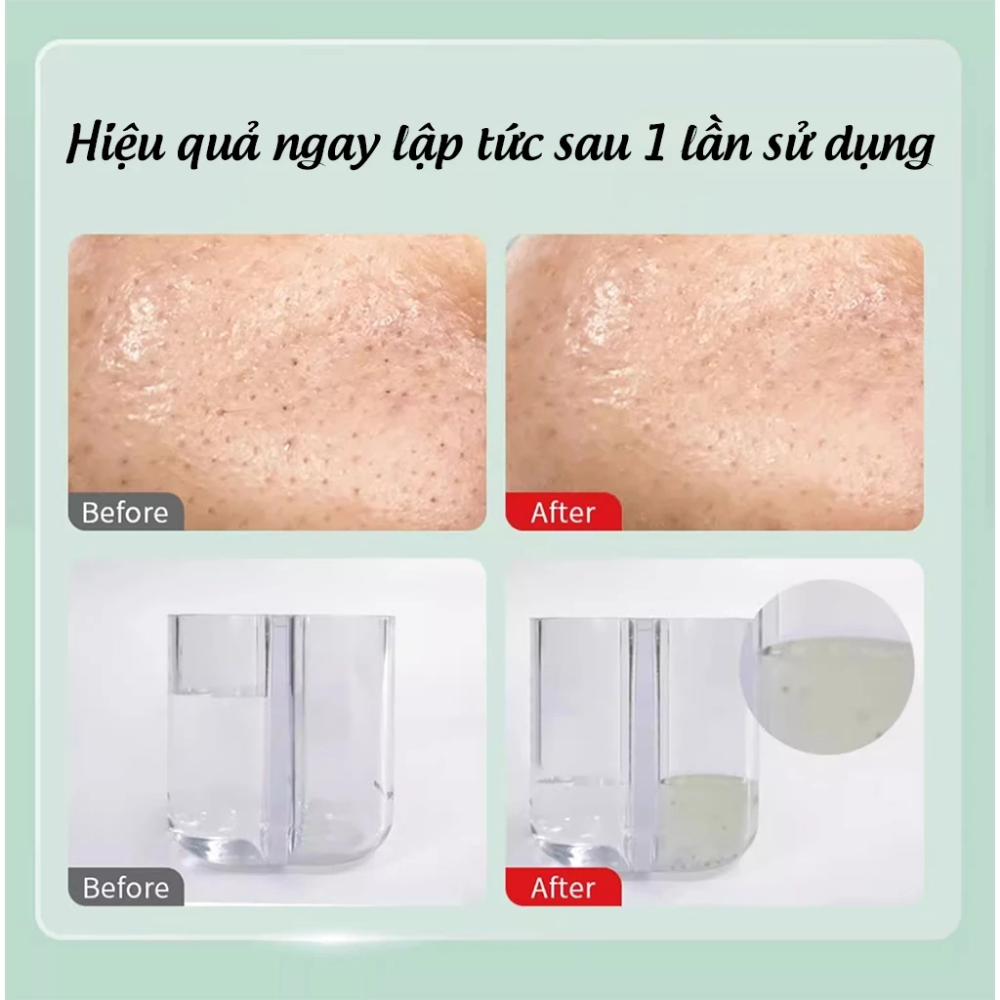 Máy Hút Mụn DOCO Đa Năng Thế Hệ Mới Nhỏ Gọn, 3 Chế Độ Hút Làm Sạch, Bảo Hành 2 Năm
