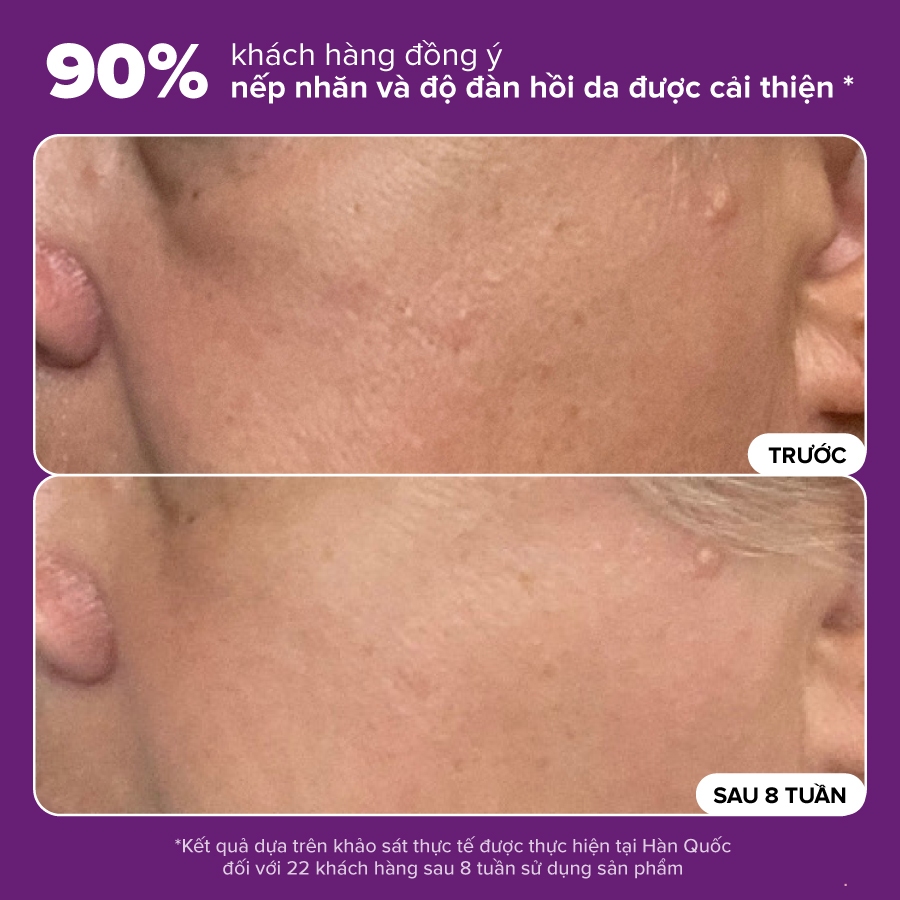 Ảnh Tinh chất se khít lỗ chân lông và làm mờ thâm mụn Paula's Choice Niacinamide 20% Treatment 20ml 8030 3