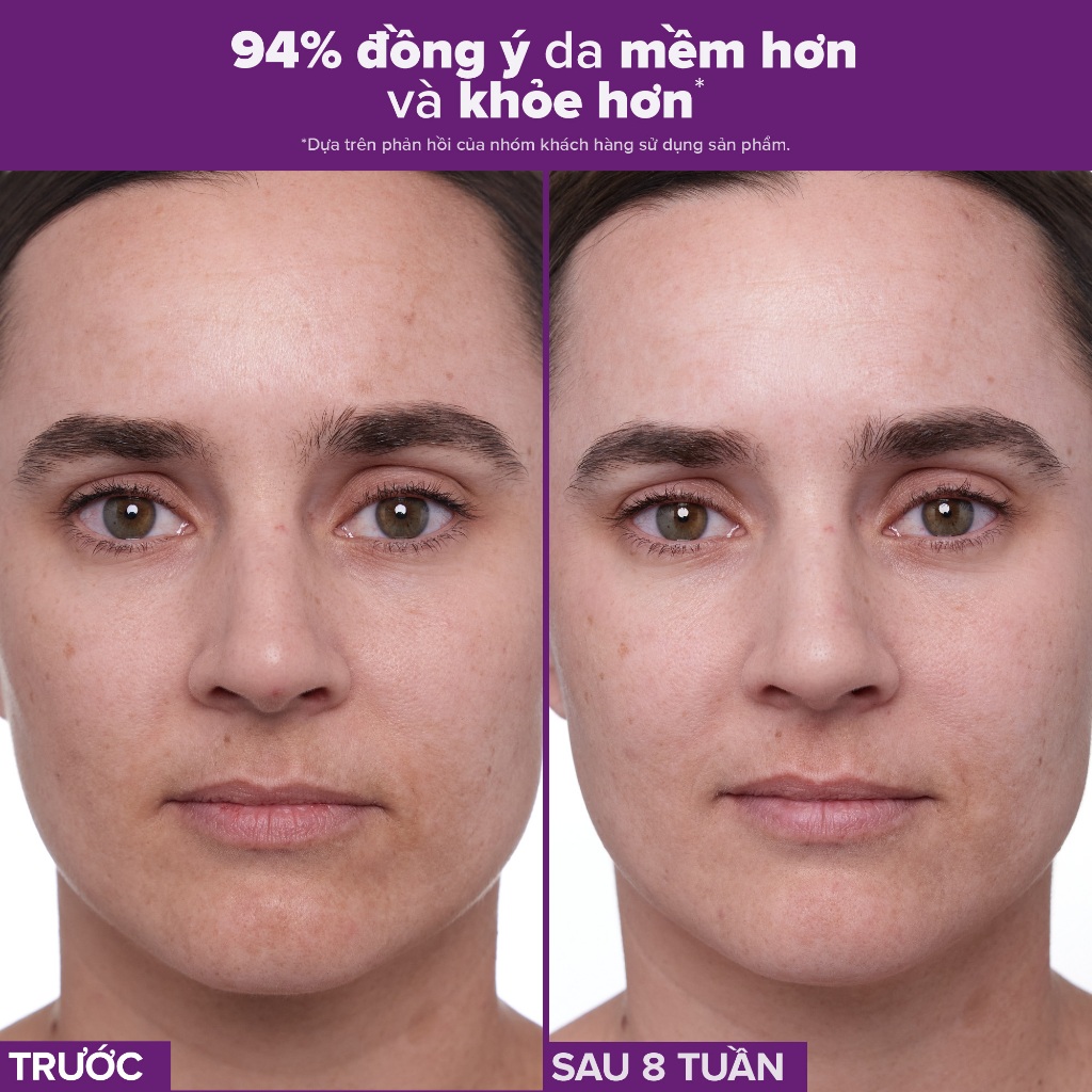 Ảnh Tinh chất làm mờ nám và nếp nhăn Paula’s Choice Clinical 1% Retinol Treatment 30 ml 8010 4