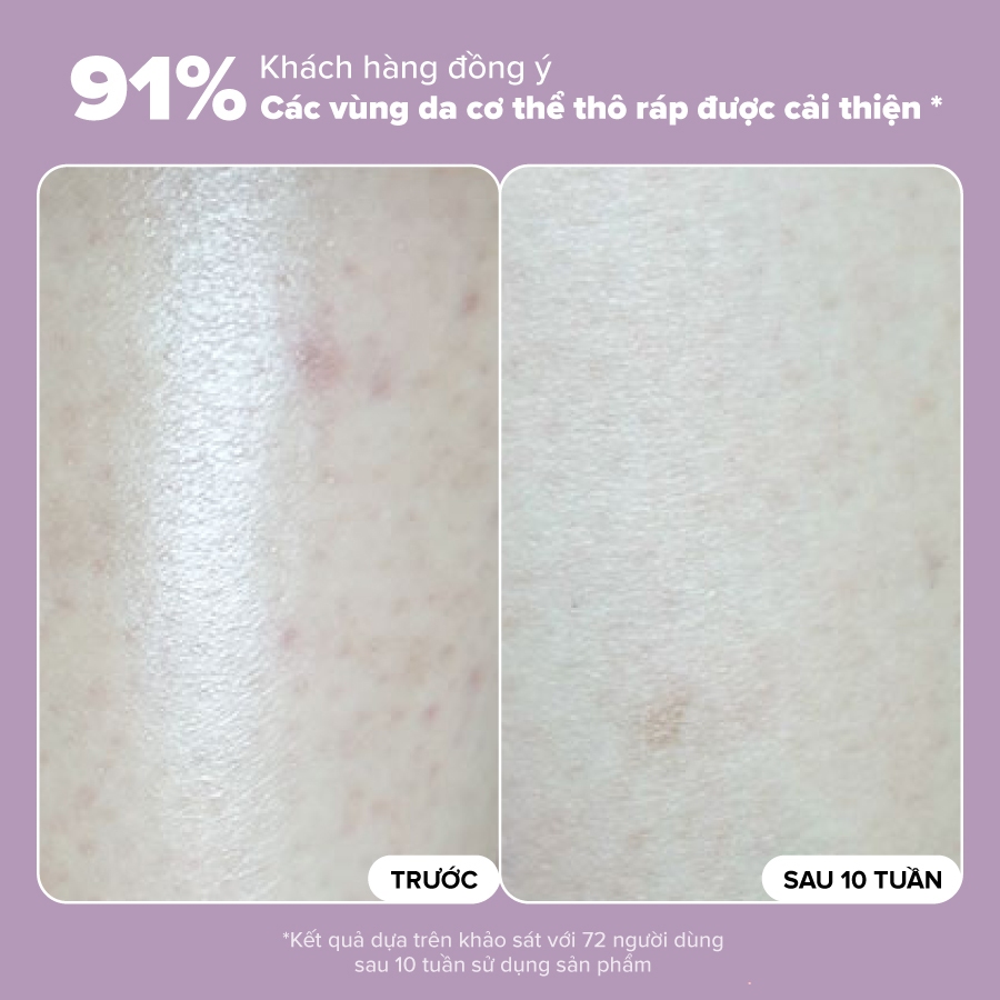 Ảnh Kem dưỡng thể làm sáng da chứa AHA 10% Paula's Choice Skin Revealing Body Lotion 10% AHA 210ml - 5900 4