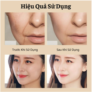 [Hàn Quốc] Serum Nhân Sâm Xóa Nếp Nhăn Vĩnh Viễn Loại Bỏ Thâm Nám Tàn Nhang Dưỡng Da Trắng Mịn Rạng Rỡ 50ML