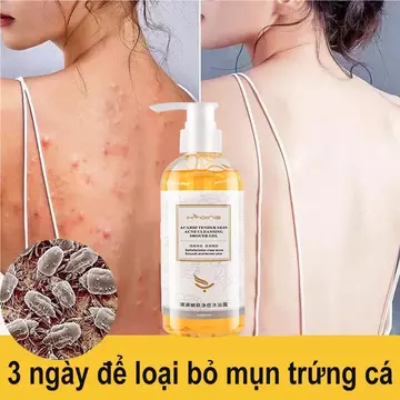 sữa tắm trắng da Sữa tắm chống ve sữa tắm viêm nang lông 260ML Làm sạch sâu bụi bẩn dưới da Cải thiện mụn trứn