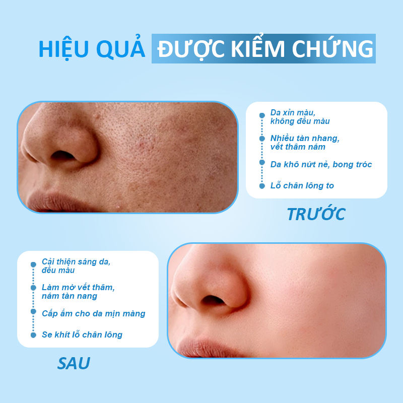 Serum Dưỡng Trắng 7day Chuyên Sâu 40ml Thu Nhỏ Lỗ Chân Lông Cân Bằng Bã Nhờn Làm Sáng Da Niacinamide 20%