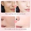 Tinh Chất Niacinamide 15% Làm Sáng Da, Giảm Thâm Mụn, Cân Bằng Dầu Nhờn – Thẩm Thấu Nhanh