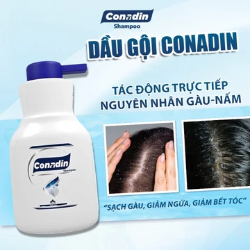 [Giá combo ưu đãi] Dầu gội trị gàu Conadin ngăn ngừa nấm da dầu, mềm mượt tóc kiểm soát dầu thừa chai 285ml