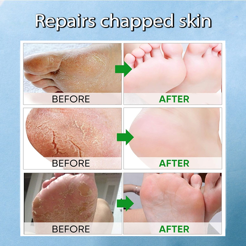 Sữa dưỡng ẩm làm trắng da Vaseline, làm trắng, dưỡng ẩm và phục hồi làn da nứt nẻ, 500ml