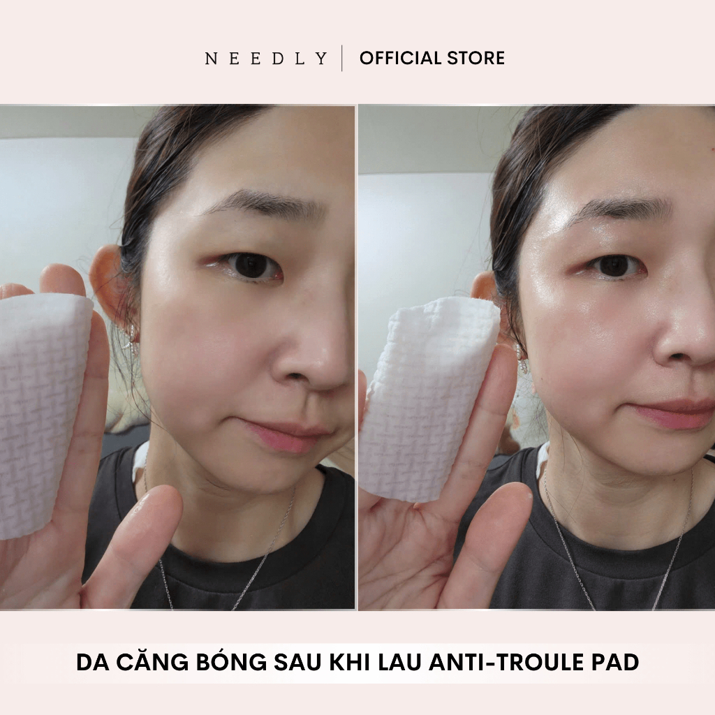 Ảnh Toner Pad Needly Anti-Trouble Làm Sạch Bã Nhờn Căng Bóng 250G 60 Miếng & Túi Refill Daily Toner Pad 1