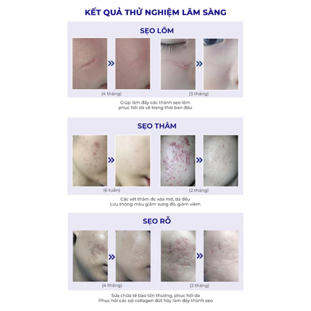 Scar Esthetique 60ml - Kem Làm Mờ Sẹo Thâm Sẹo Rỗ Sẹo Lõm Sẹo Mụn
