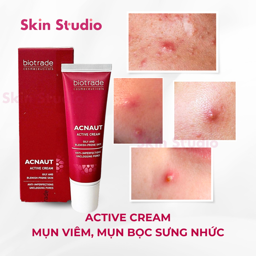 Combo Kem Chấm Mụn Biotrade Acnaut Cream + Lotion cho da mụn viêm giảm mụn ngừa thâm - Skin Studio