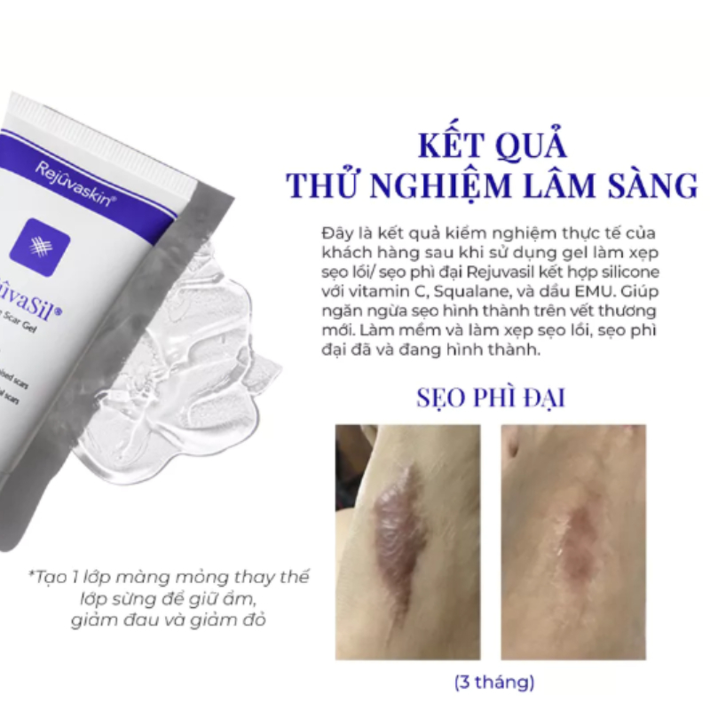Rejuvasil Kem Sẹo Lồi, Sẹo Phẫu Thuật Siêu Mượt 30ml