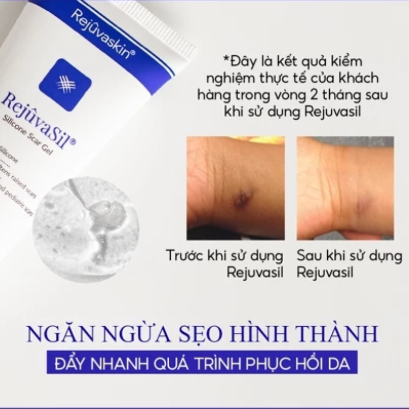 Rejuvasil Kem Sẹo Lồi, Sẹo Phẫu Thuật Siêu Mượt 30ml