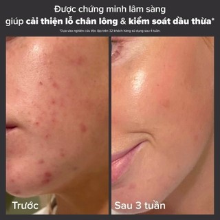 Dung dịch tẩy tế bào chết paula's choice Skin Perfecting 2% BHA Liquid 118ml