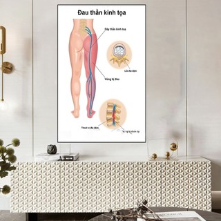 [Tranh Y Khoa] Tranh Tráng Gương Bo Viền Cao Cấp - Tranh Đau Thần Kinh Toạ