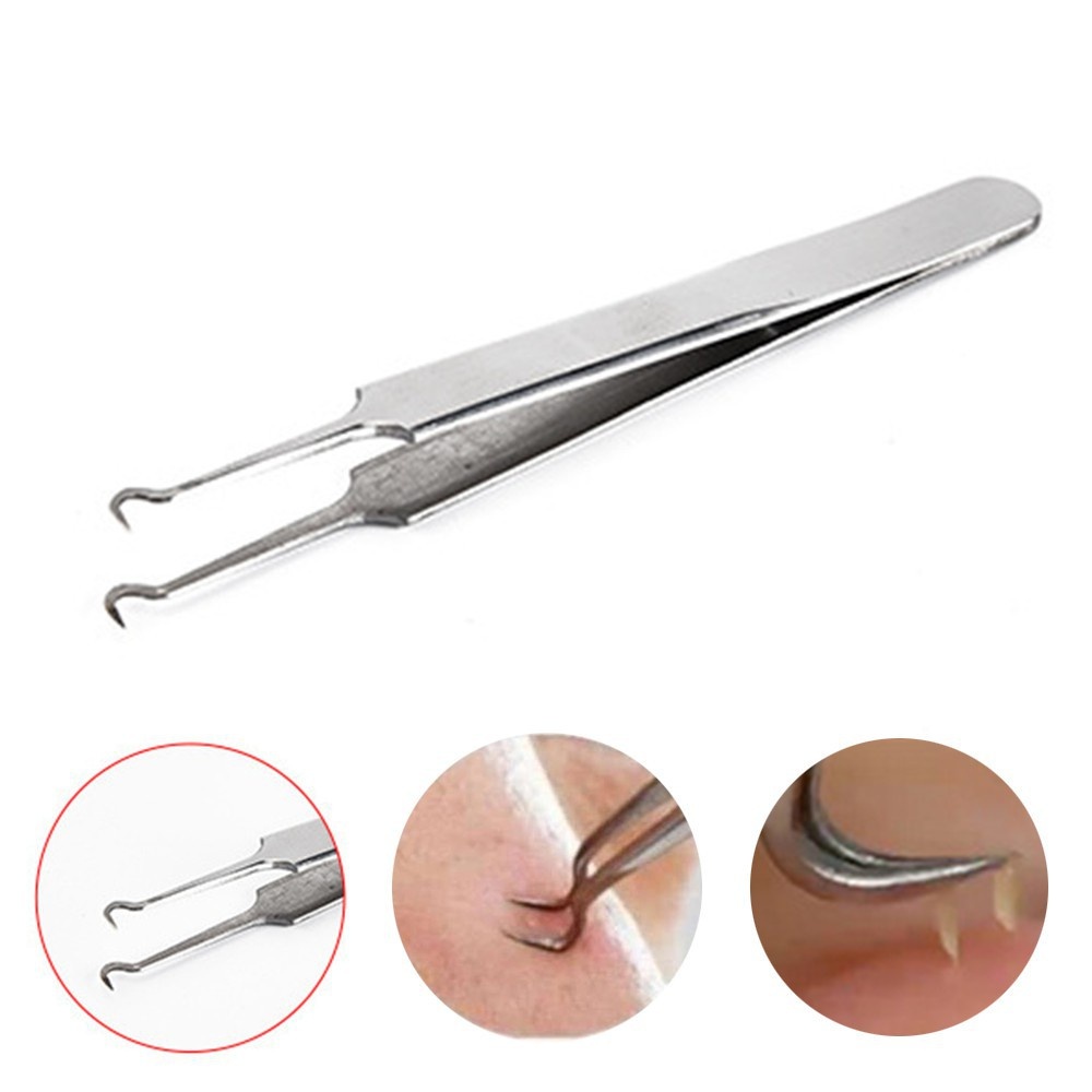 Nhíp Gắn Mụn Đầu Cong, Dùng Gắp Mụn Đầu Đen, Mụn Cám, Sợi Bã Nhờn, Sử Dụng Tiện Lợi