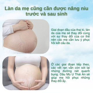 Dầu Mù U Nguyên Chất Ép Lạnh Thái An Xỏ Khuyên Tai Hỗ Trợ Các Vấn Đề Về Da Rạn Và Vết Thương - Chai10ml