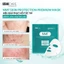 Mặt Nạ Cấp Ẩm, Cân Bằng Lợi Khuẩn, Phục Hồi Da MD CARE NMF SKIN Protection Premium Mask